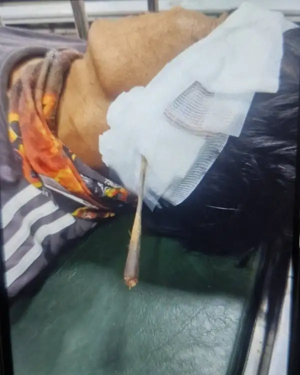 ภาพข่าว บุรีรัมย์ หวิดไม่ได้เลือกตั้งหนุ่มนอนเปลหน้าบ้านโดนลูกดอกปริศนาเข้าคอหวิดดับ - TIGER NEWS REPORT