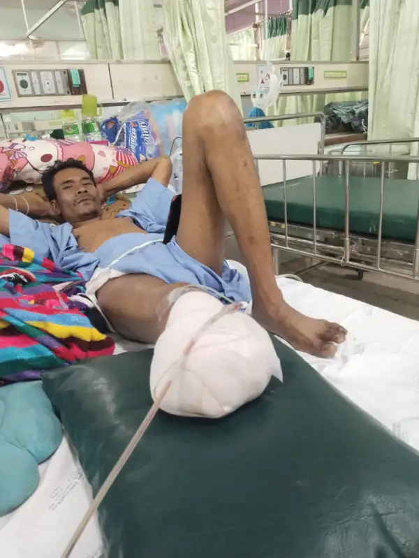 ภาพข่าว “ศรีสะเกษ” ซิ่งบิ๊กไบค์ชนลุงขาขาด เจ็บ 3 ราย หลานสาว 5 ขวบซ้อนท้ายมาด้วยกระเด็นขาหัก - TIGER NEWS REPORT