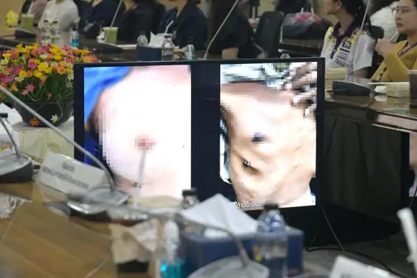 ภาพข่าว