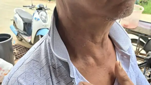 ภาพข่าว
