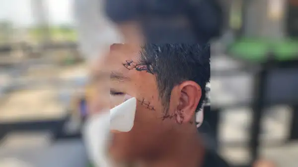 ภาพข่าว